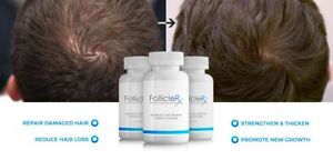 Folliclerx – remède contre la perte de cheveux - France - forum - Amazon